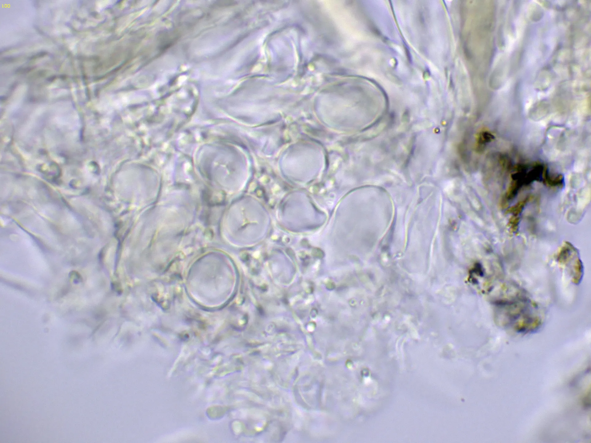 Microscopía de Glonium lineare - 14 1 - Excípulo Melzer-001